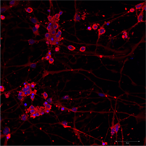 TFTL derived neurons